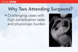 Complex Spinal Surgery: Two Attending Surgeons