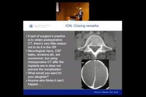 2018-S3P-Spinal Navigation-Anderson