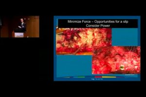 Complex Spinal Deformity How to Choose the Safest Operative Approach