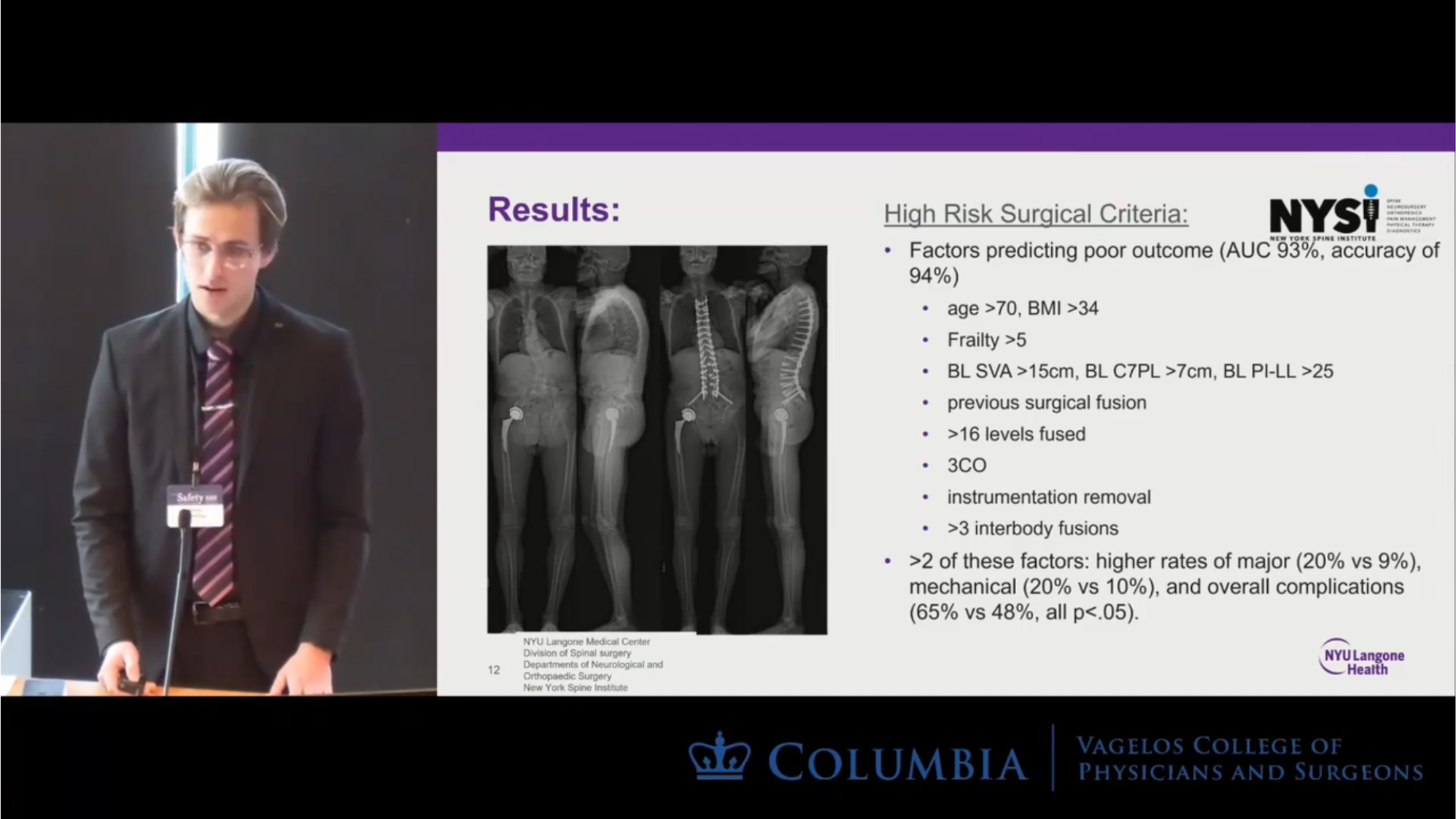 Defining a High Risk Adult Spinal Deformity Patient: Utilizing Predictive Analytics to Asses Factors Associated with Increased Risk of Medical and Surgical Complications Following Thoracolumbar Corrective Surgery