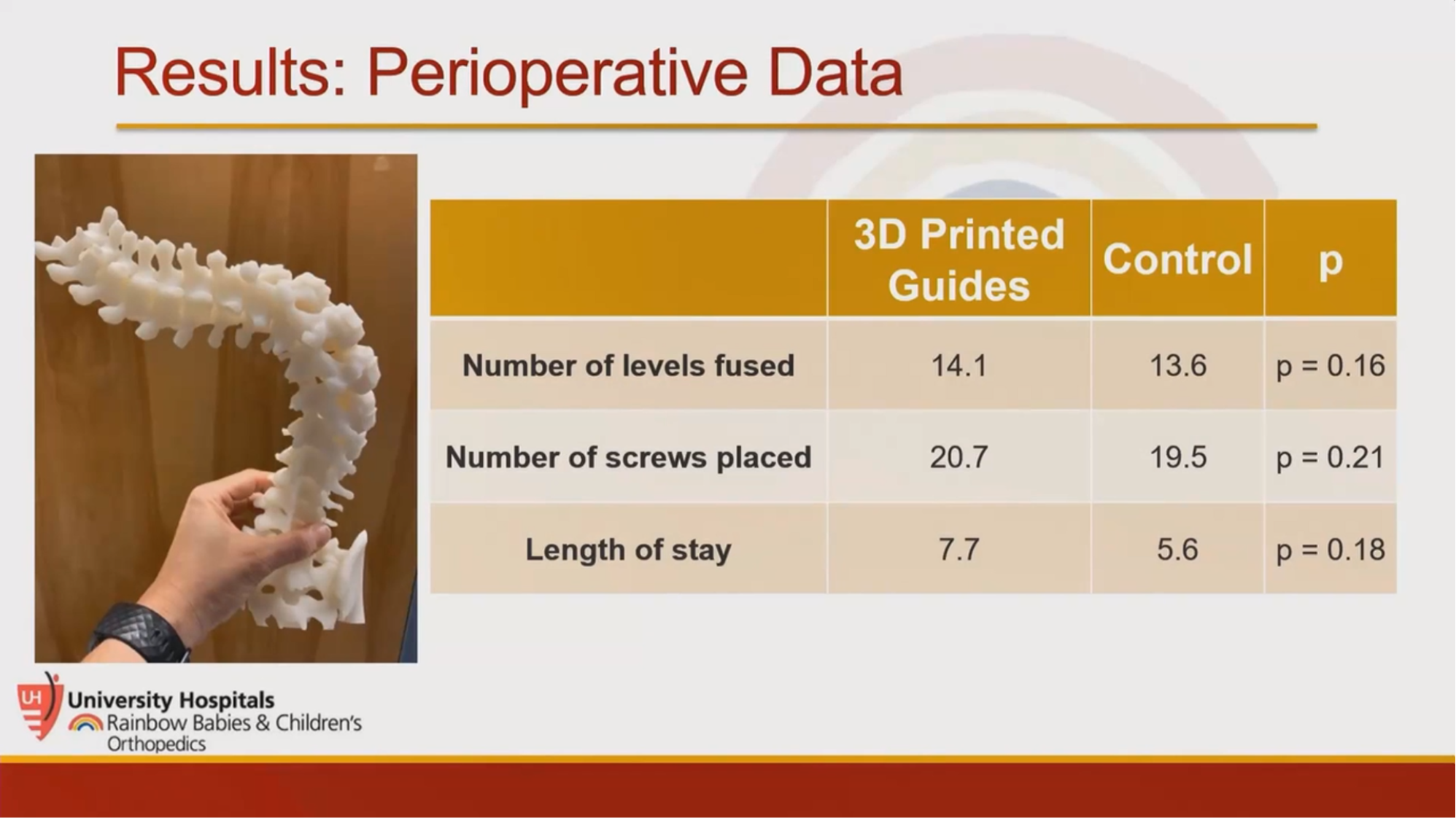 Patient Matched Comparison of Spinal Deformity Surgery Using 3D Printed Guides
