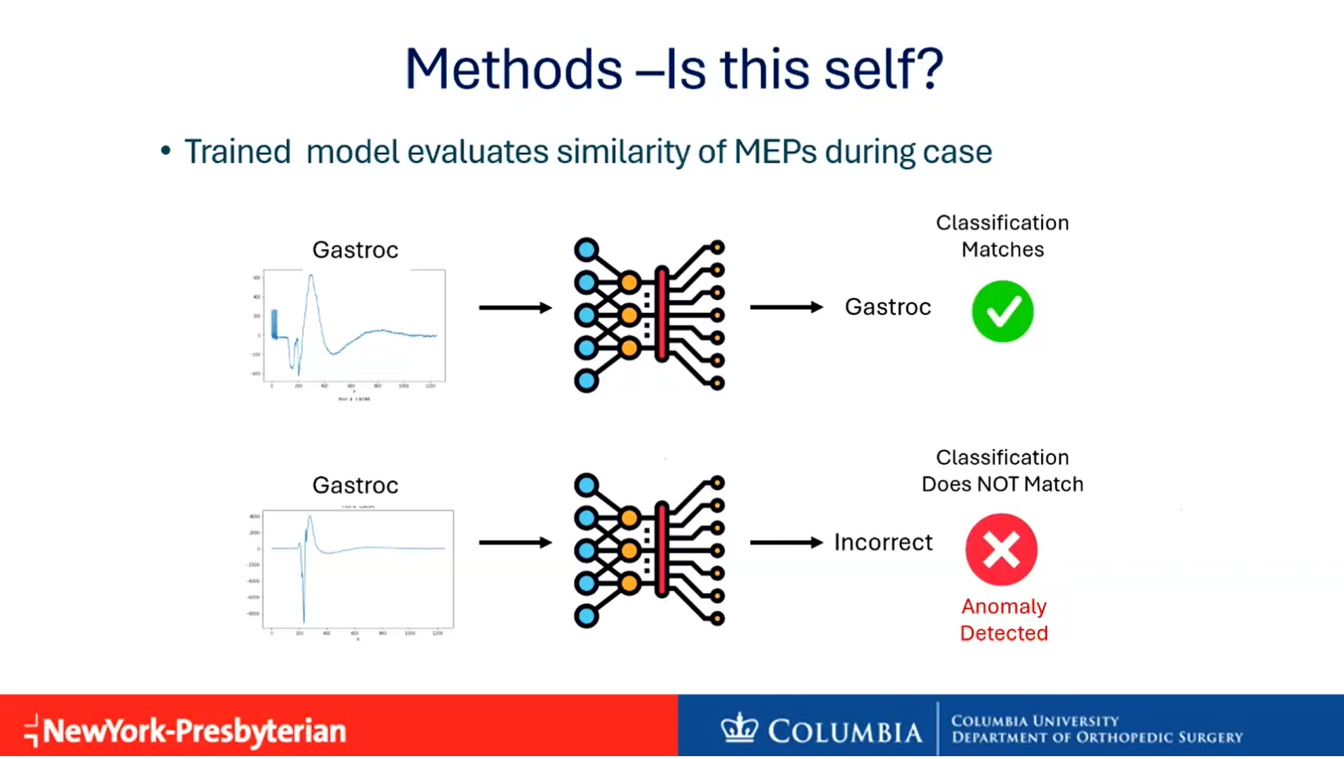 Machine Learning Models Outperform Technicians in IONM