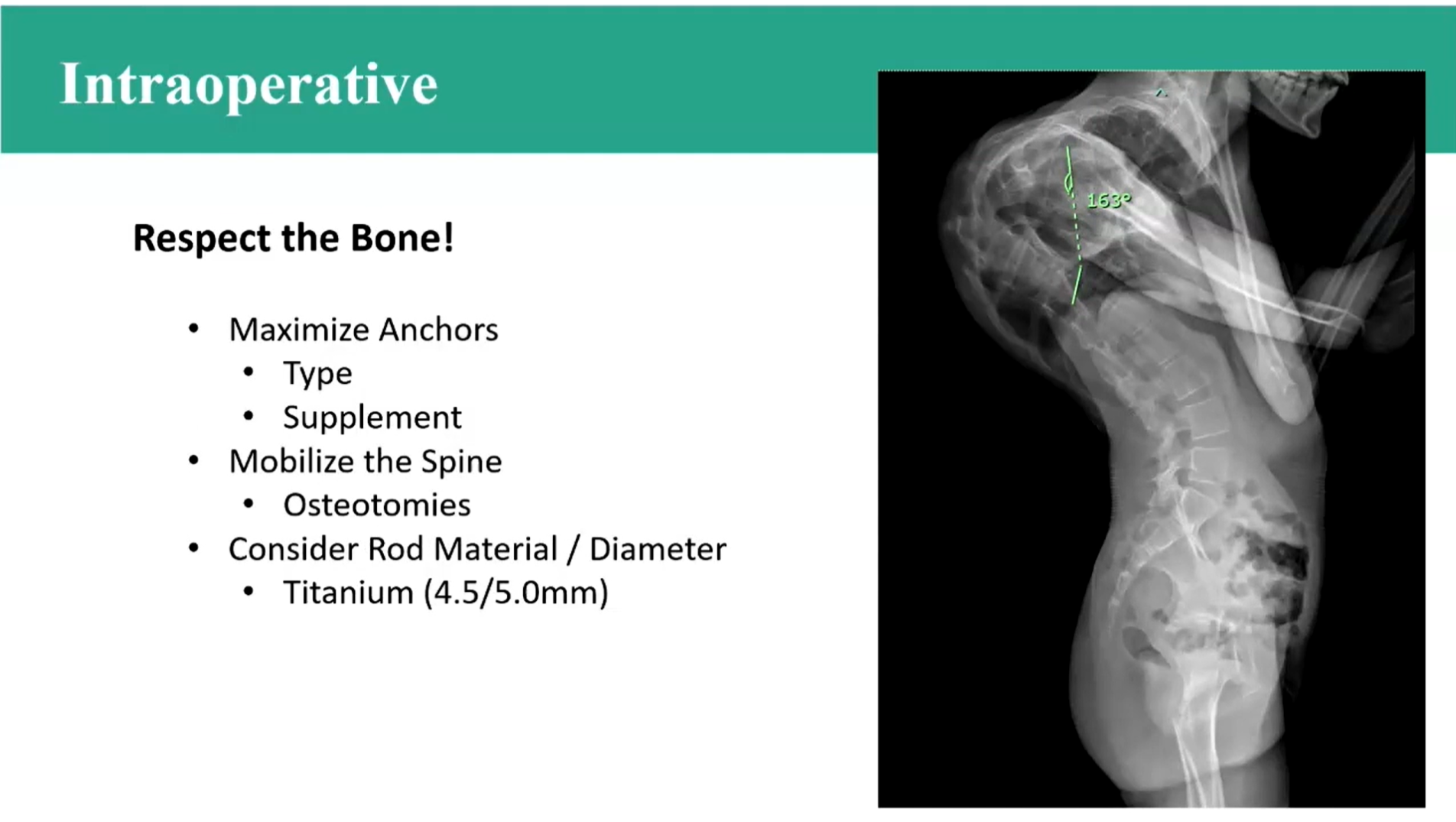 Safety in Syndromic Scoliosis
