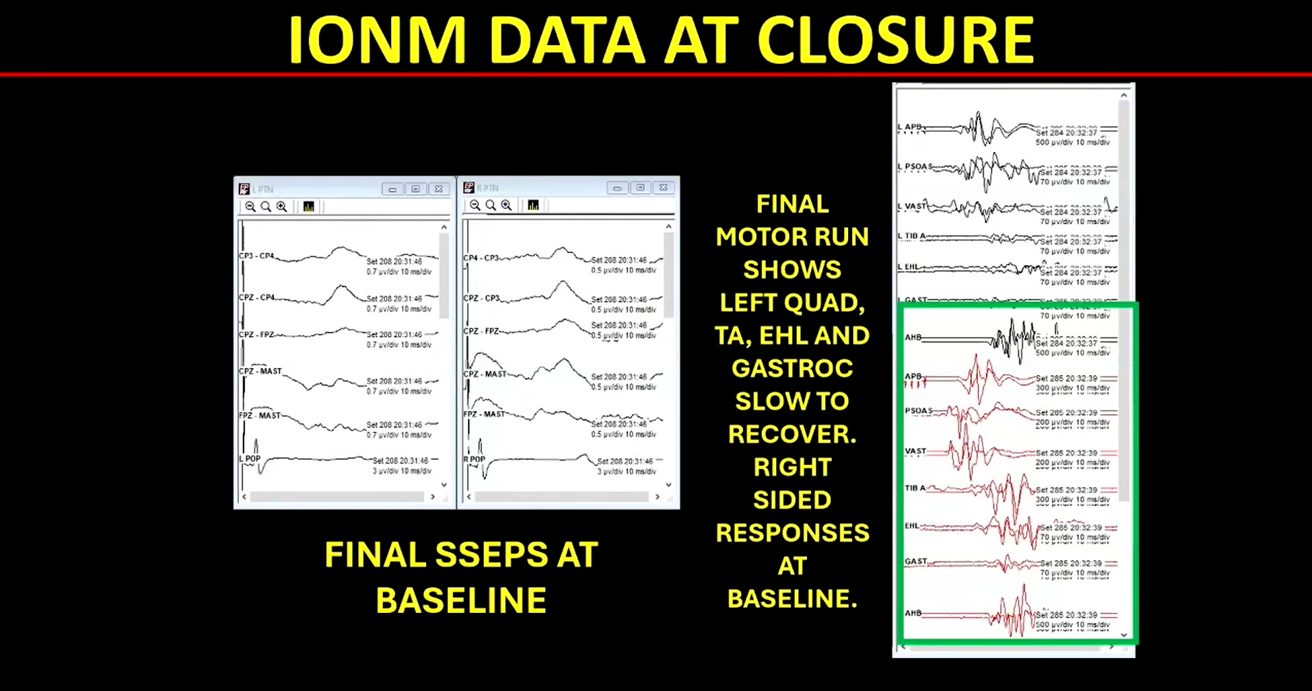 What’s New in IONM?